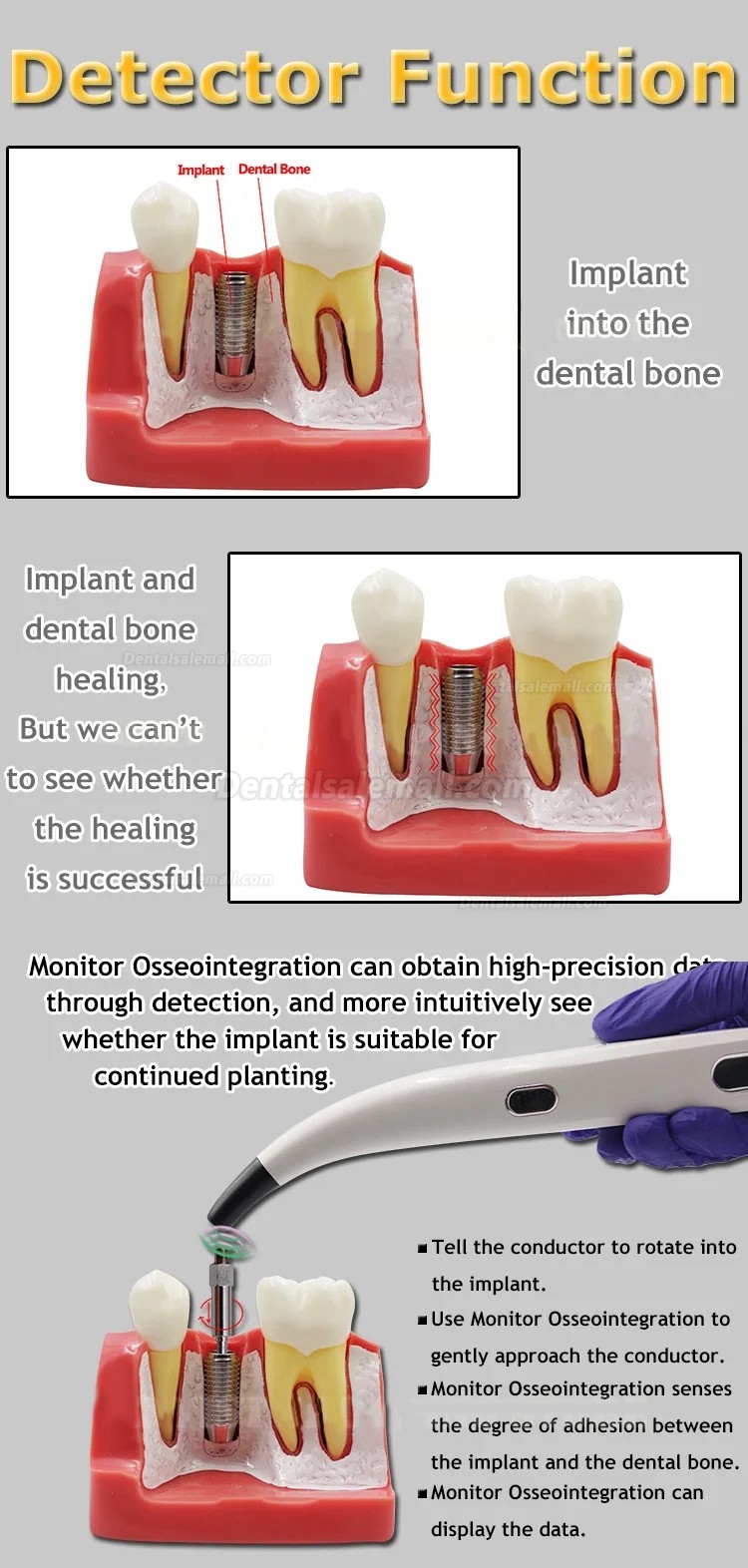 Portable Dental ISQ Implant Stability Monitor Tester Device Implant Stability Meter Measurement Device